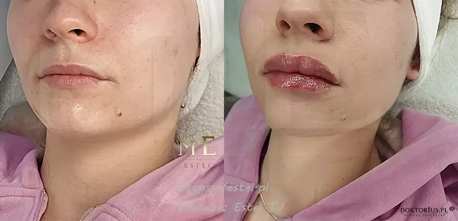technika russian lips